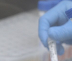 Testes são indispensáveis enquanto não se tem uma vacina contra o coronavírus